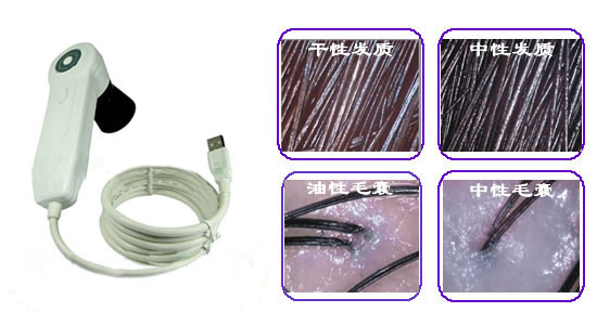 毛发检测专家--专业毛发检测仪信息